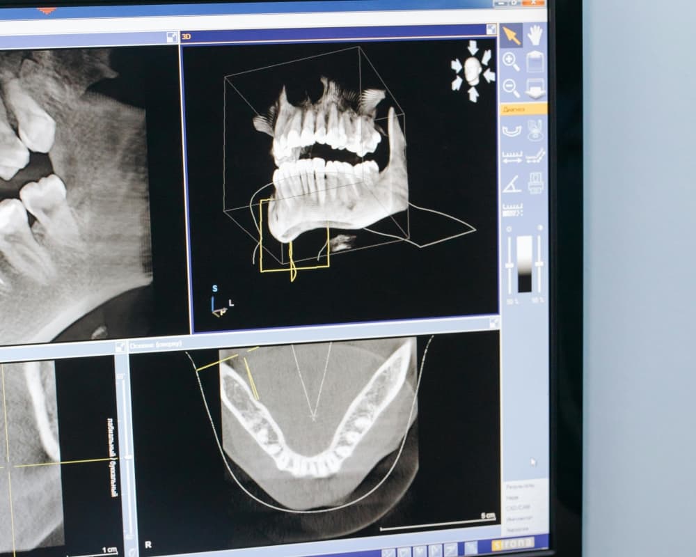 Digital X-ray - Hentges Dental Mesa, Arizona